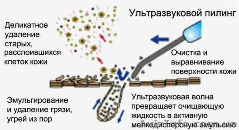 Акция! Ультразвуковая чистка лица -  в подарок 2 процедуры = 150 грн - <ro>Изображение</ro><ru>Изображение</ru> #2, <ru>Объявление</ru> #1172138