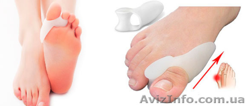 Супер цена!!! Успейте купить Valgus Pro!!!  - <ro>Изображение</ro><ru>Изображение</ru> #4, <ru>Объявление</ru> #1171178