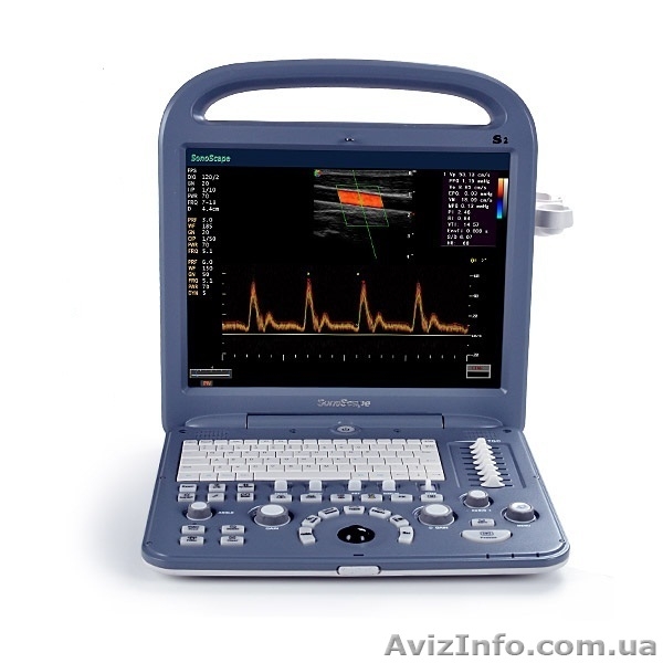 УЗ сканер SonoScape S2 - <ro>Изображение</ro><ru>Изображение</ru> #1, <ru>Объявление</ru> #1251244