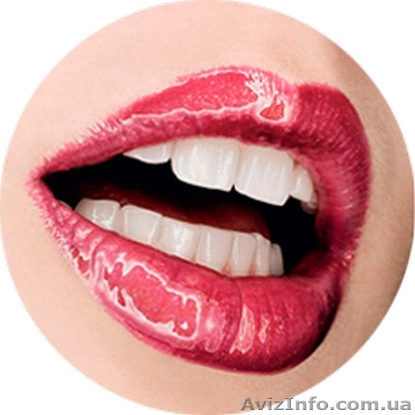 Отбеливание зубов системой Beyond Polus в Киеве в ЭстетСмайл - <ro>Изображение</ro><ru>Изображение</ru> #3, <ru>Объявление</ru> #1358585