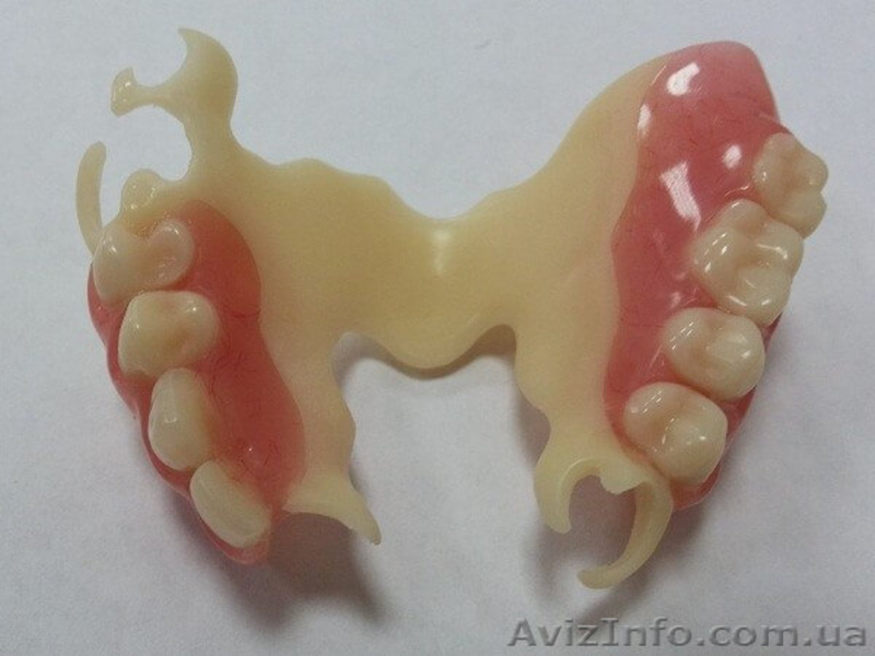 Зуботехнические работы - <ro>Изображение</ro><ru>Изображение</ru> #2, <ru>Объявление</ru> #1447161