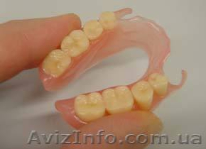 Зуботехнические работы - <ro>Изображение</ro><ru>Изображение</ru> #1, <ru>Объявление</ru> #1447161