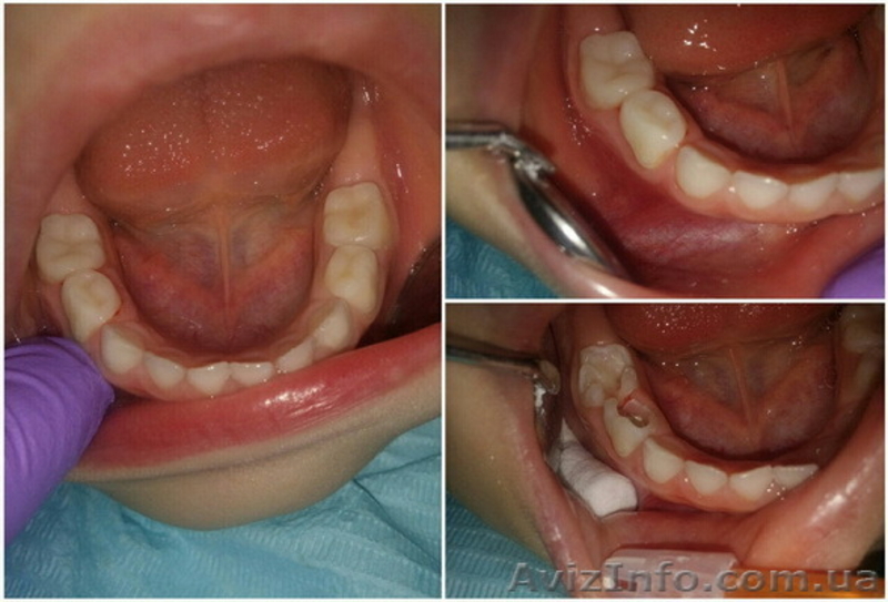 Детская стоматология Multident в Киеве - <ro>Изображение</ro><ru>Изображение</ru> #4, <ru>Объявление</ru> #1507761