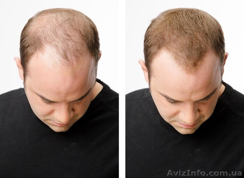 Загуститель Волос Toppik Большой 25г - <ro>Изображение</ro><ru>Изображение</ru> #3, <ru>Объявление</ru> #1547322