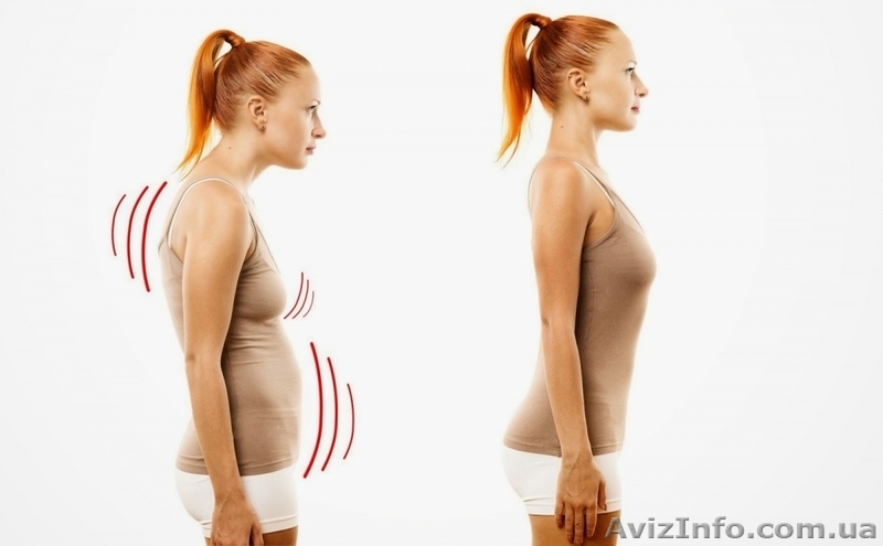 Исцеление от сколиоза, лордоза, кифоза, межпозвоночных грыж без упражнений - <ro>Изображение</ro><ru>Изображение</ru> #7, <ru>Объявление</ru> #1622350