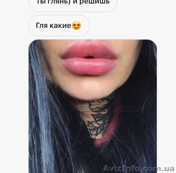 Увеличение, коррекция губ  - <ro>Изображение</ro><ru>Изображение</ru> #3, <ru>Объявление</ru> #1632127