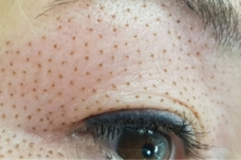 Медсестра устанавливает капельницы, уколы, катетеры, косметологи на дому в Киев - <ro>Изображение</ro><ru>Изображение</ru> #3, <ru>Объявление</ru> #1652363