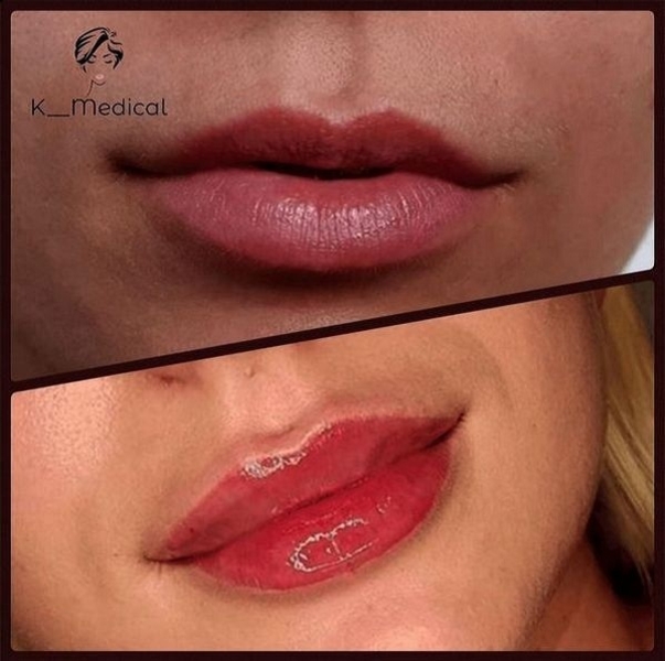 Врач косметолог в Киеве. - <ro>Изображение</ro><ru>Изображение</ru> #1, <ru>Объявление</ru> #1669426