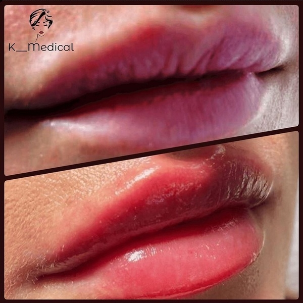 Врач косметолог в Киеве. - <ro>Изображение</ro><ru>Изображение</ru> #2, <ru>Объявление</ru> #1669426