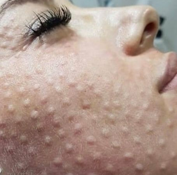 Врач-косметолог, услуги в сфере эстетической медицины - <ro>Изображение</ro><ru>Изображение</ru> #5, <ru>Объявление</ru> #1697208