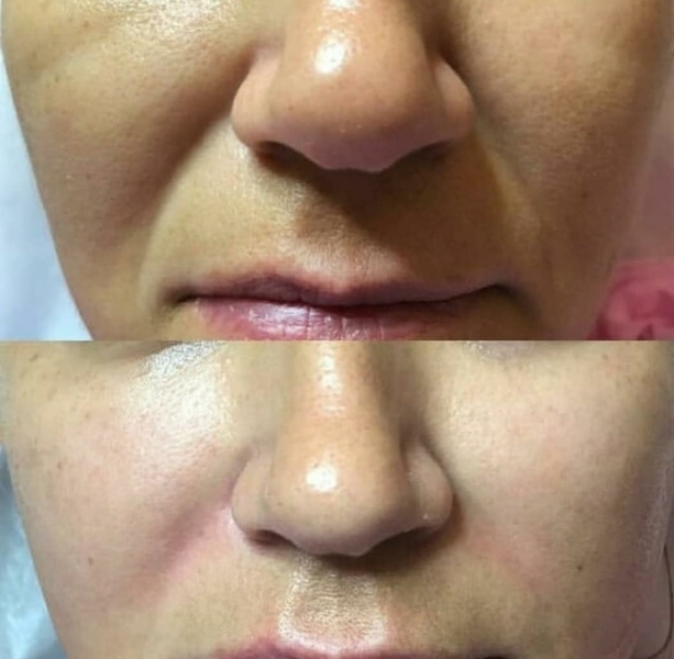 Врач-косметолог, услуги в сфере эстетической медицины - <ro>Изображение</ro><ru>Изображение</ru> #4, <ru>Объявление</ru> #1697208