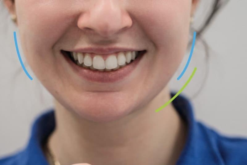 D.Ante - современная стоматология в центре Киева - <ro>Изображение</ro><ru>Изображение</ru> #1, <ru>Объявление</ru> #1714235